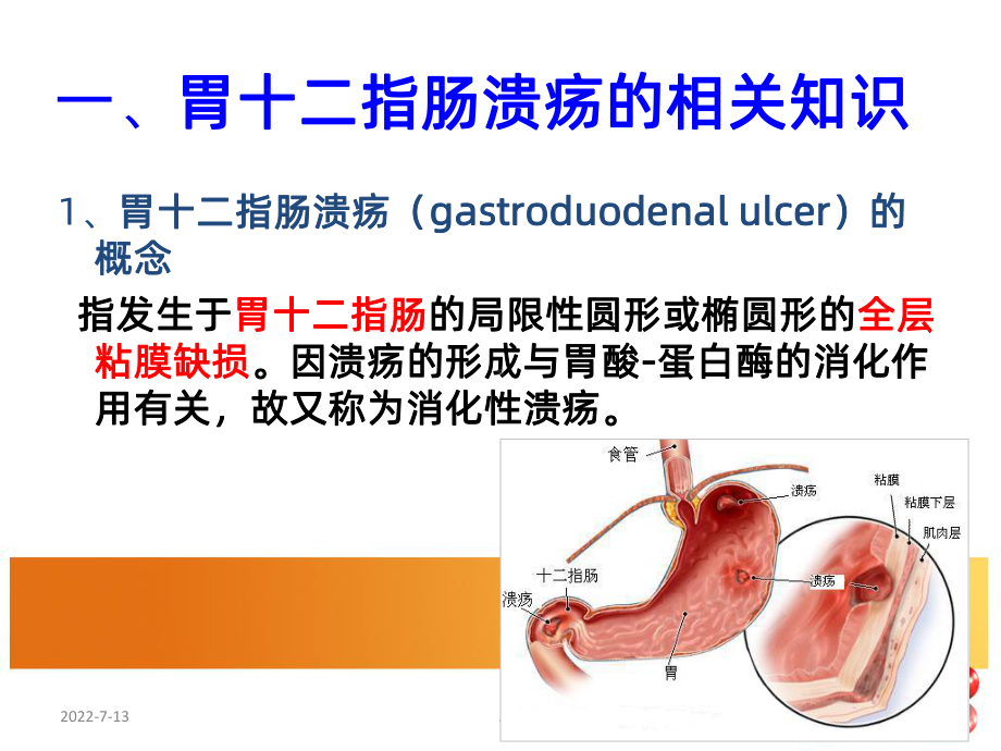 胃十二指肠溃疡病人的-护理PPT课件.ppt_第3页