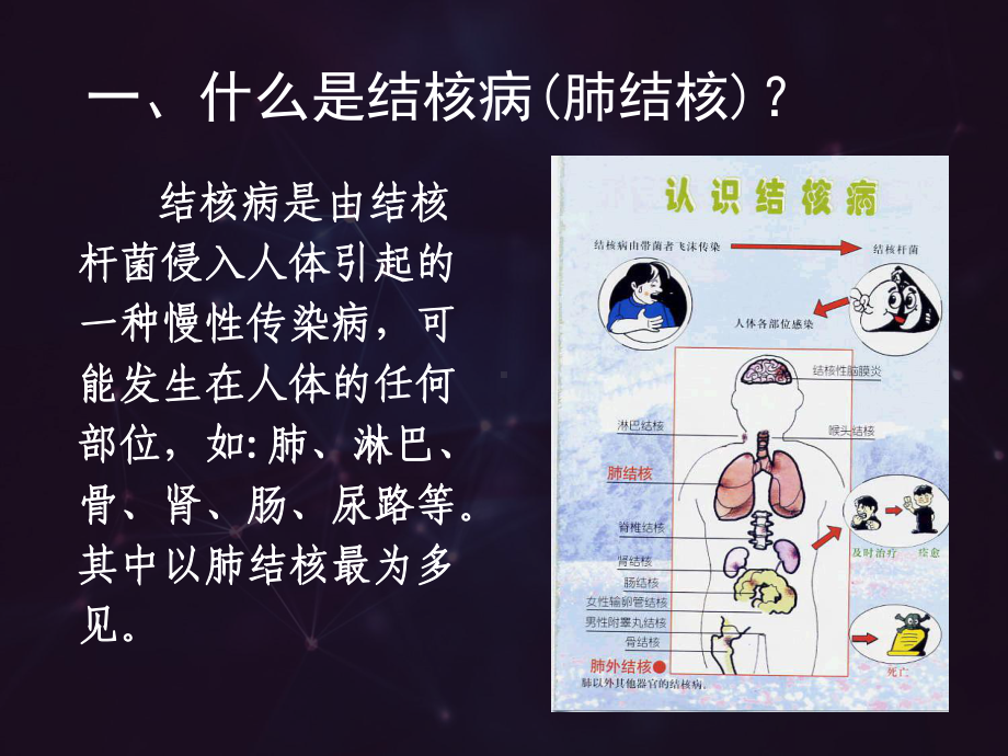 肺结核防治知识-ppt课件.ppt_第2页