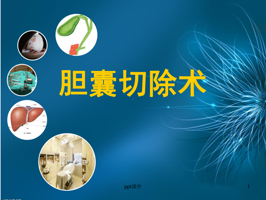 胆囊切除术-ppt课件.ppt_第1页