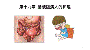 肠梗阻病人的护理PPT课件.pptx