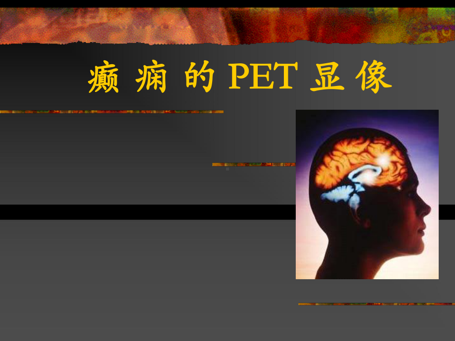 癫痫的PET显像NAMIOhio课件.ppt_第1页