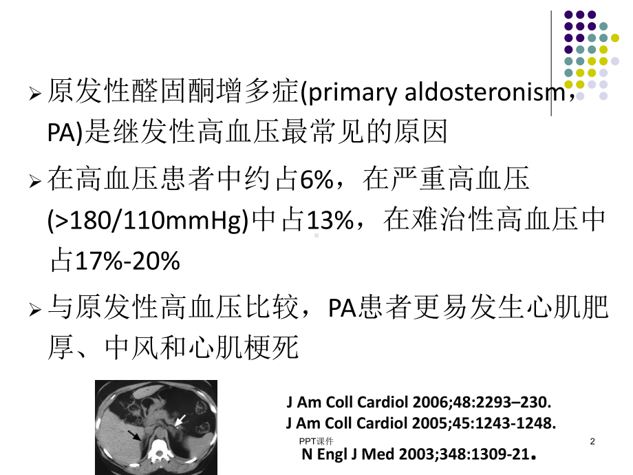 分侧肾上腺静脉取血-ppt课件.ppt_第2页