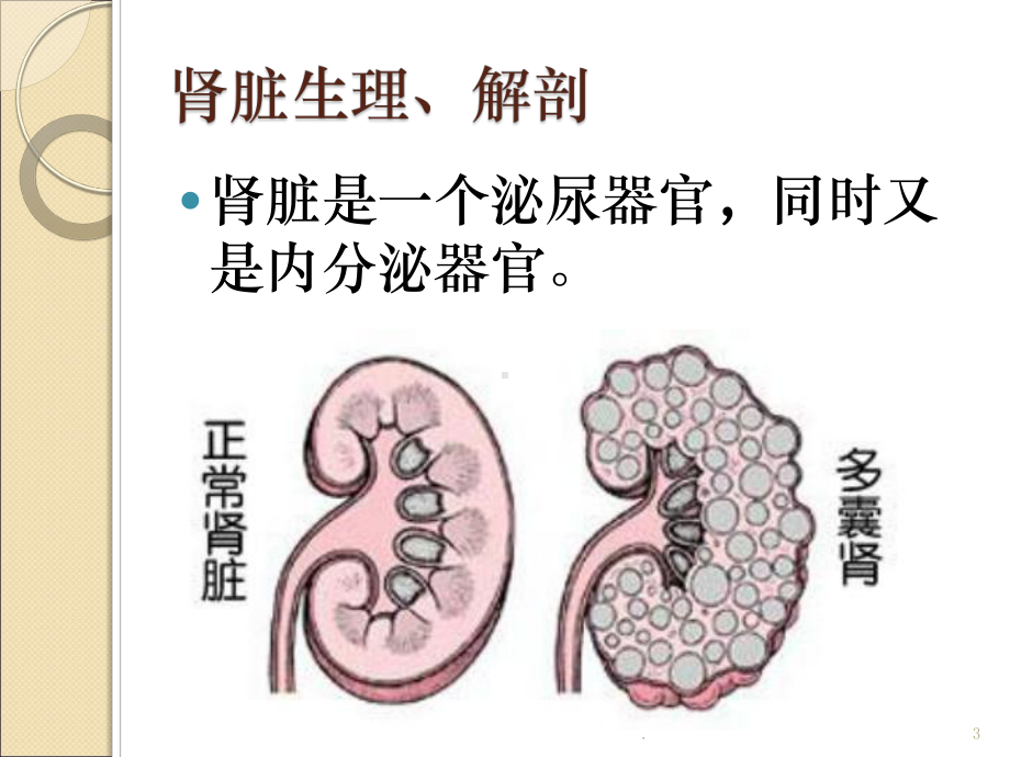 (医学课件)多囊肾ppt演示课件.pptx_第3页