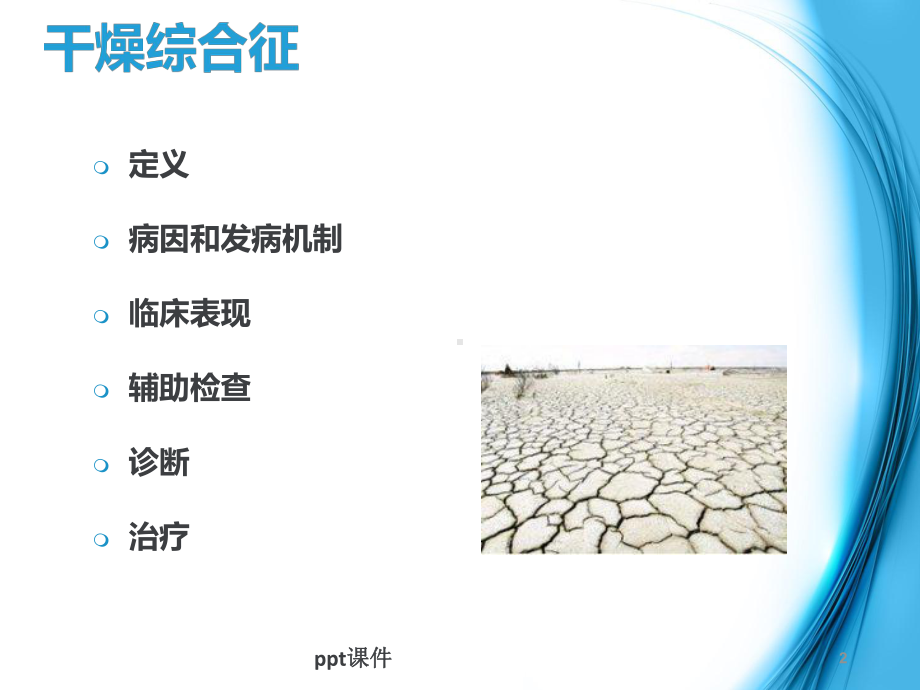 干燥综合征护理查房-ppt课件.ppt_第2页