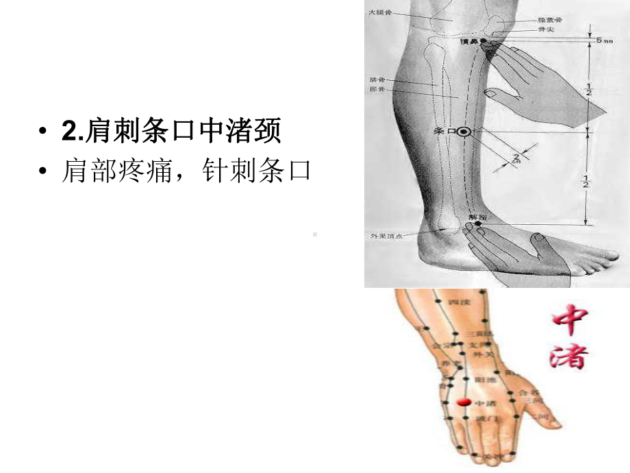 各种疼痛的针灸治疗穴位讲义课件.ppt_第2页