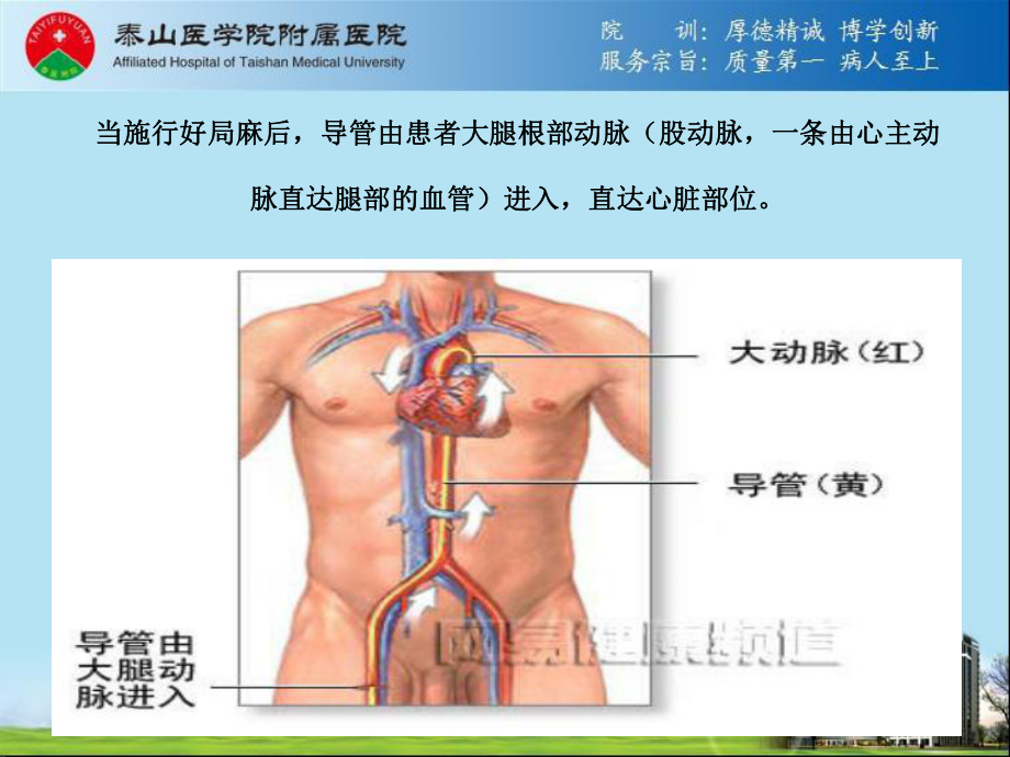 PCI术后并发症原因PPT课件1.ppt_第2页