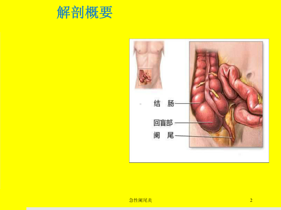 急性阑尾炎培训课件.ppt_第2页