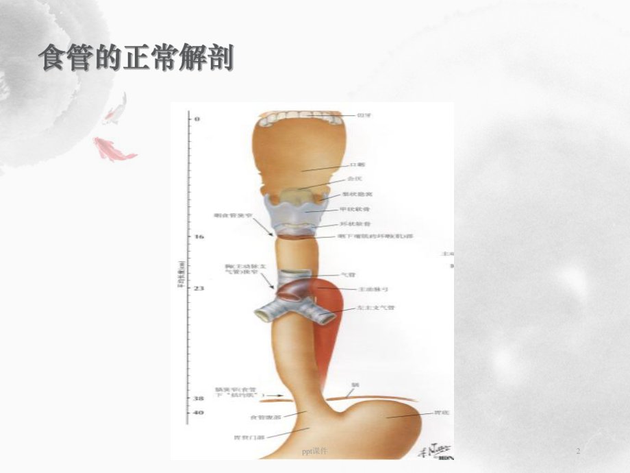 食管闭锁-ppt课件.ppt_第2页