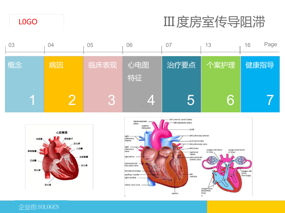 心内房室传导阻滞的护理查房课件.ppt_第2页