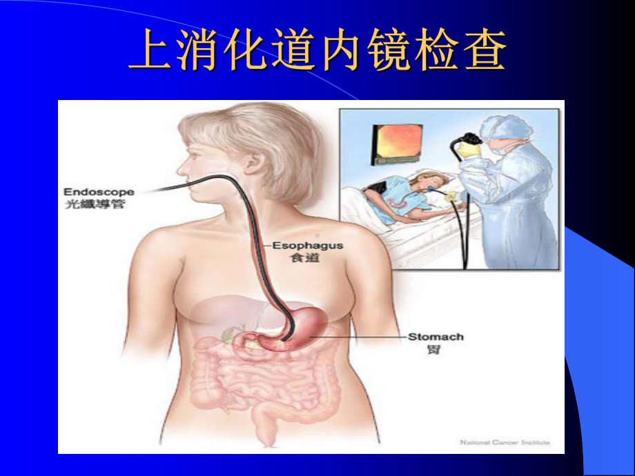 胃肠镜检查前后注意事项1课件.ppt_第2页