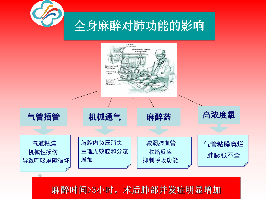 布地奈德混悬液在胸外科围手术期的应用价值课件.ppt_第2页