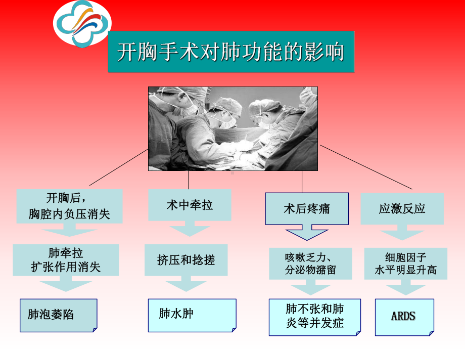 布地奈德混悬液在胸外科围手术期的应用价值课件.ppt_第3页