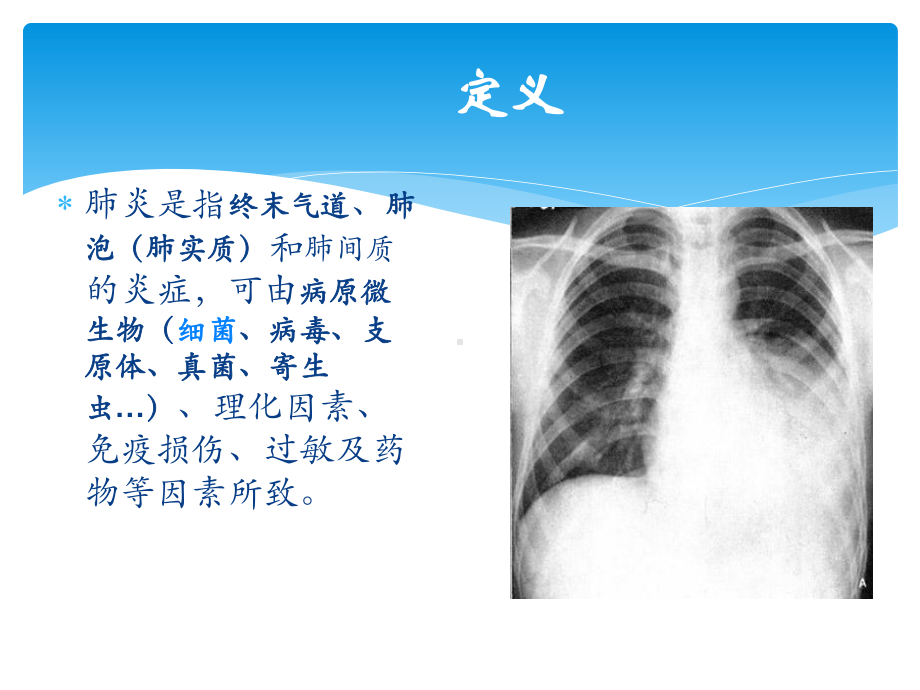 肺炎诊治过程课件.pptx_第2页