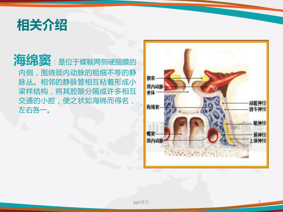 颈动脉海绵窦瘘的护理-ppt课件.ppt_第2页