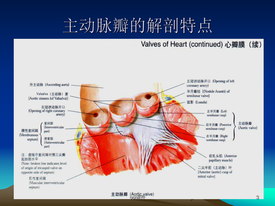 主动脉瓣疾病-ppt课件.ppt_第3页