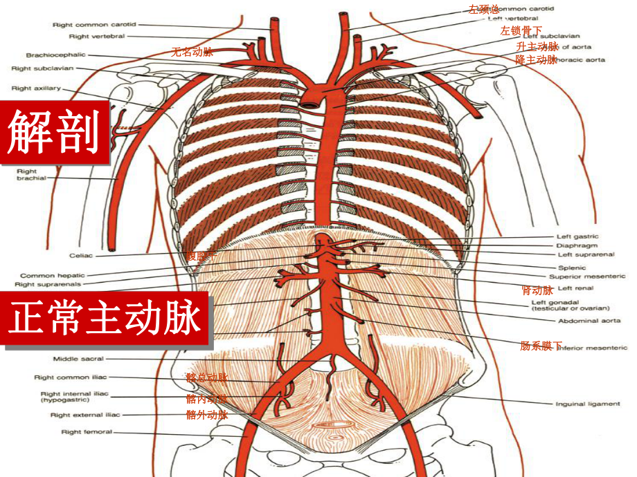 主动脉夹层的介入治疗与护理PPT课件.ppt_第3页