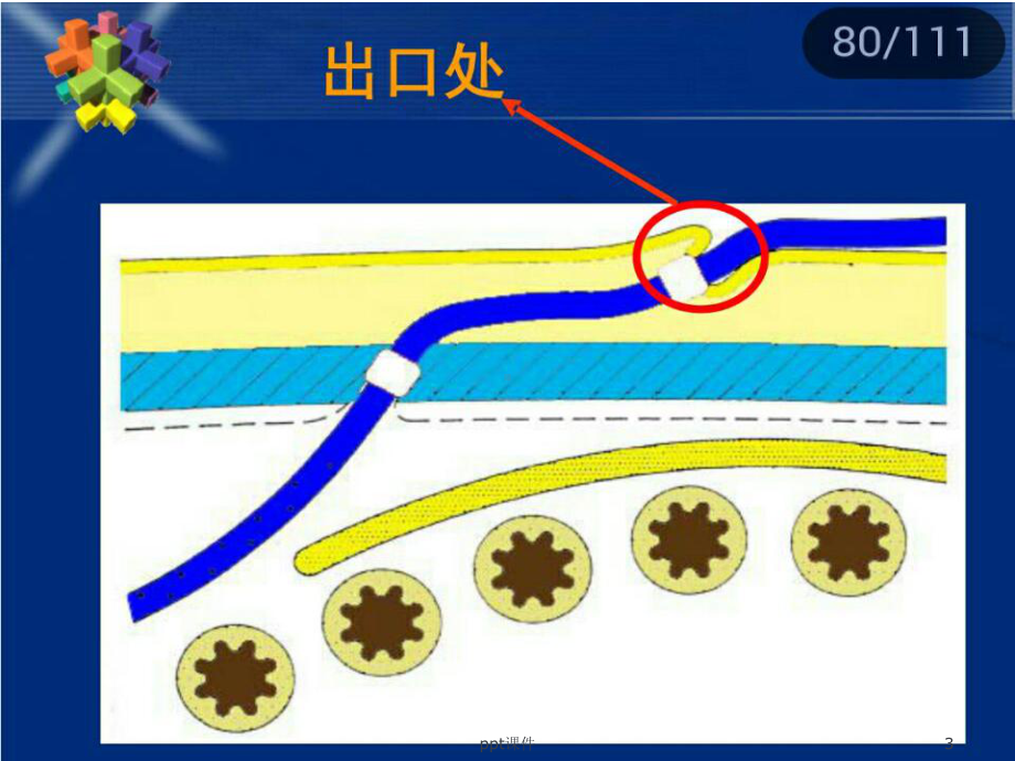 腹膜透析出口护理-ppt课件.ppt_第3页