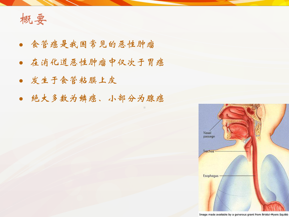 食管癌-ppt课件.ppt_第2页