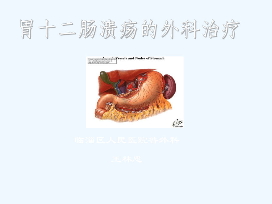 胃十二指肠溃疡的外科治疗1课件.ppt_第1页