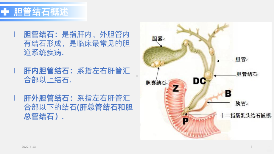 胆管结石PPT课件.ppt_第3页