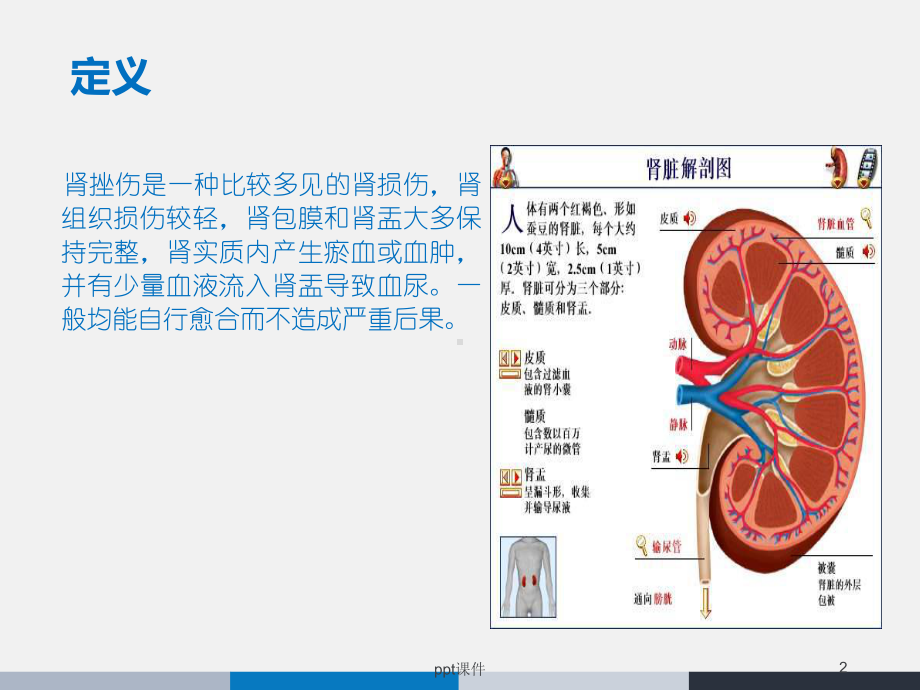 肾挫伤的业务学习-ppt课件.ppt_第2页