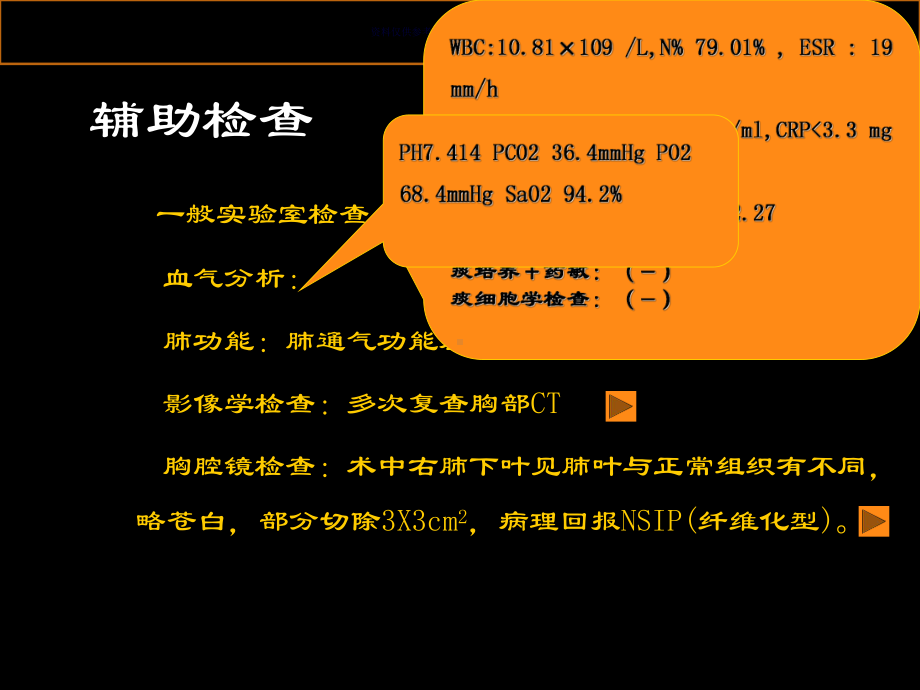 非特异性间质性肺炎病例分析课件.ppt_第2页