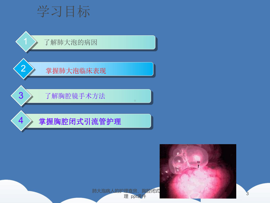 肺大泡病人的护理查房胸腔闭式引流的护理-ppt课课件.ppt_第3页