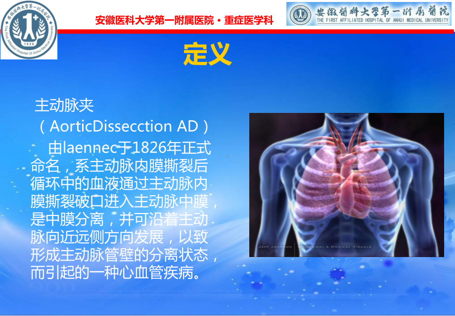 主动脉夹层完整版本课件.ppt_第2页