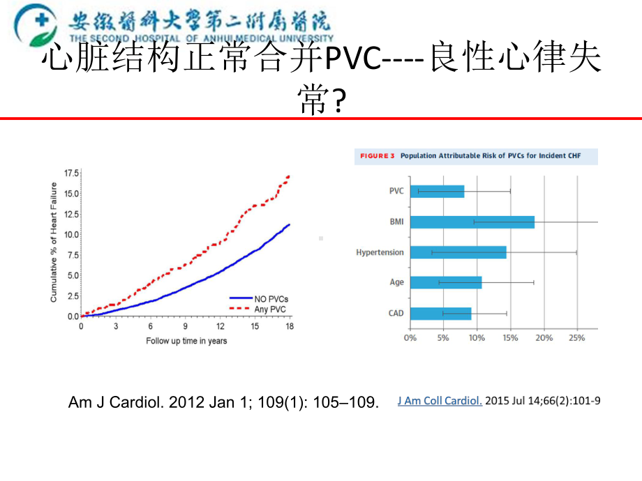 室性心律失常射频消融优质PPT课件.ppt_第2页