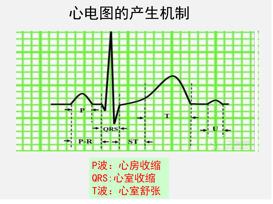 第三节心律失常病人-的护理PPT课件.ppt_第3页