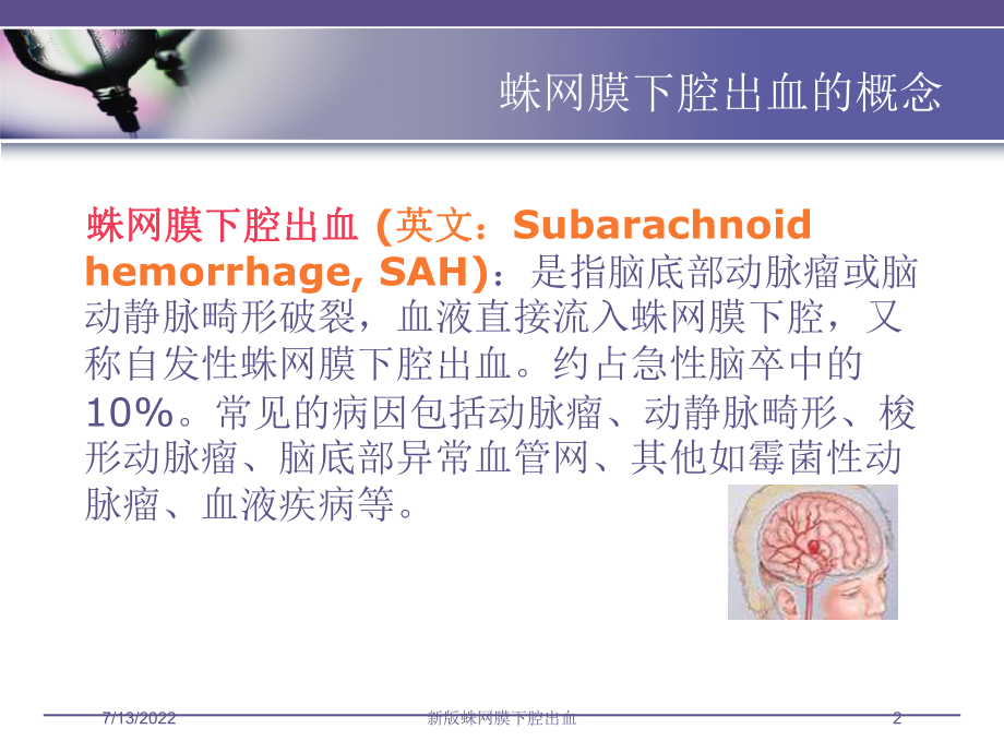 新版蛛网膜下腔出血培训课件.ppt_第2页