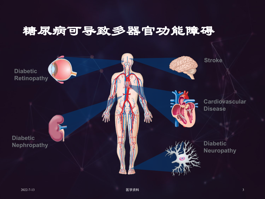 糖尿病（内分泌科）-ppt课件.ppt_第3页