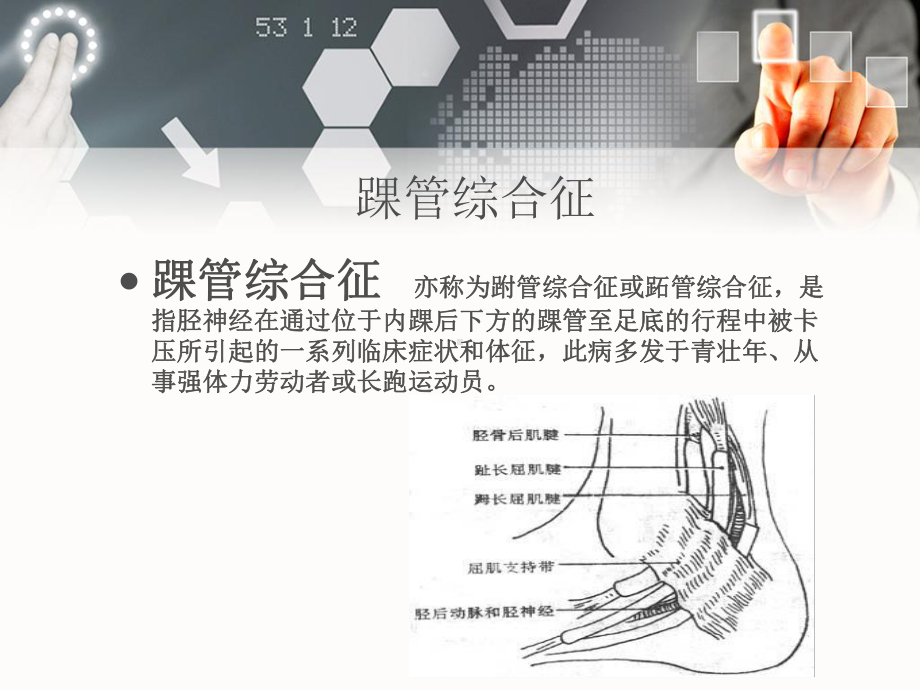 踝管综合征-ppt课件.ppt_第2页