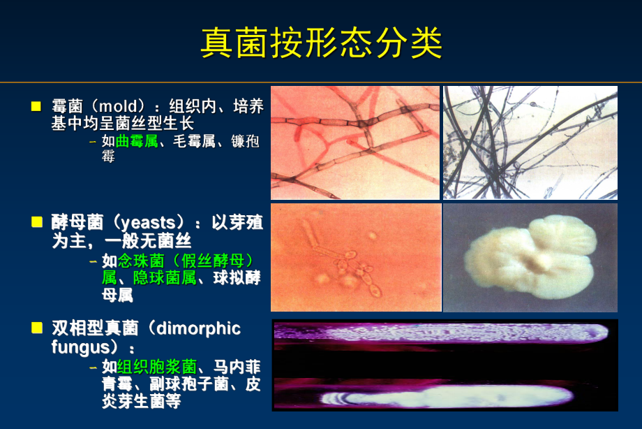 侵袭性肺曲霉病课件.ppt_第2页