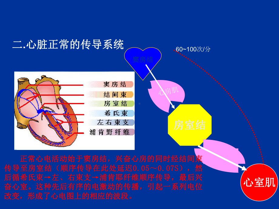 室性心律失常课件.pptx_第3页