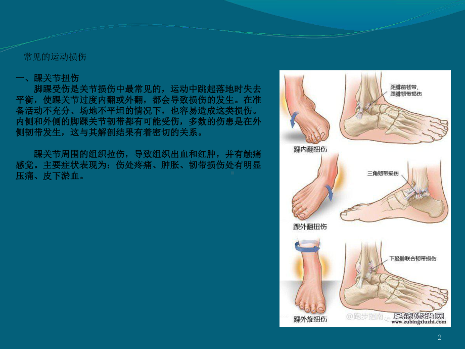 常见损伤应急处理与急救ppt课件.ppt_第2页