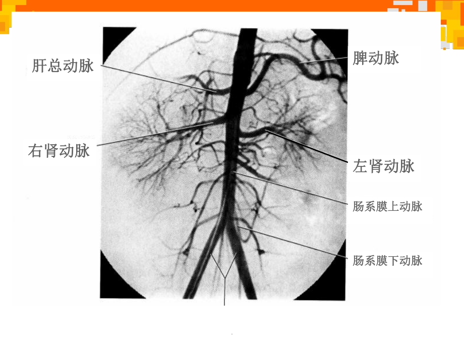 腹部血管解剖与变异PPT演示课件.ppt_第3页