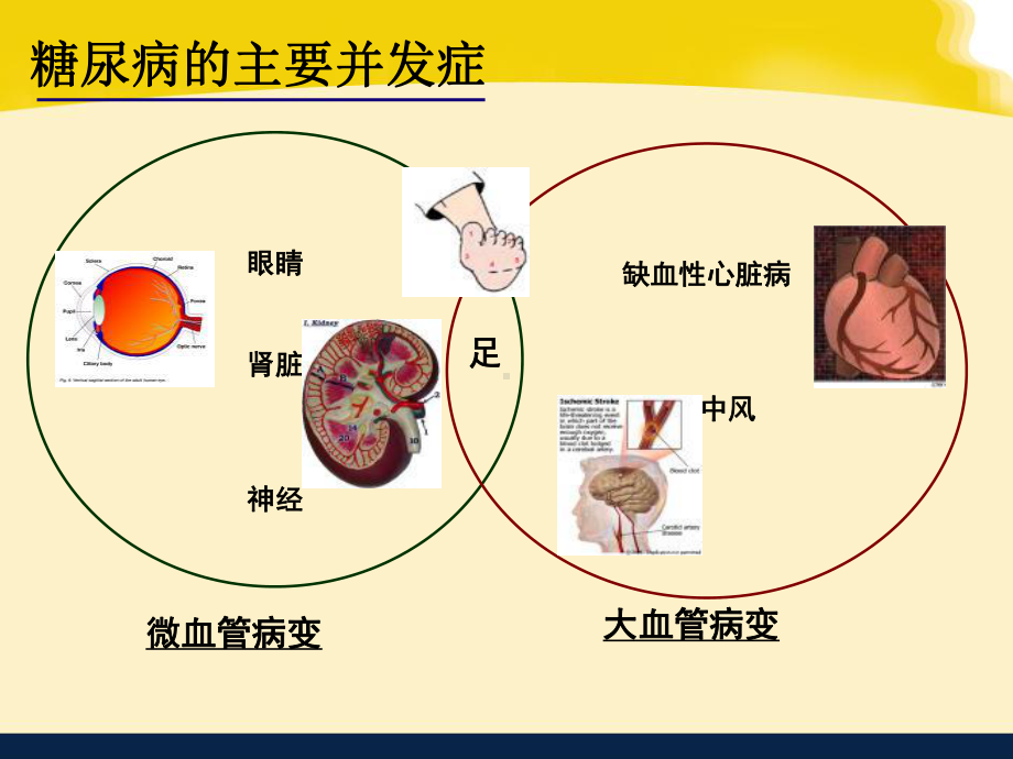 糖尿病肾病的饮食健康教育精编PPT课件.ppt_第2页