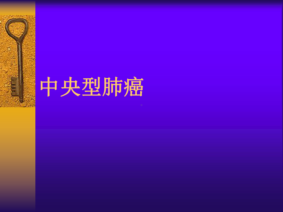 原发性支气管肺癌PPT课件1.ppt_第3页