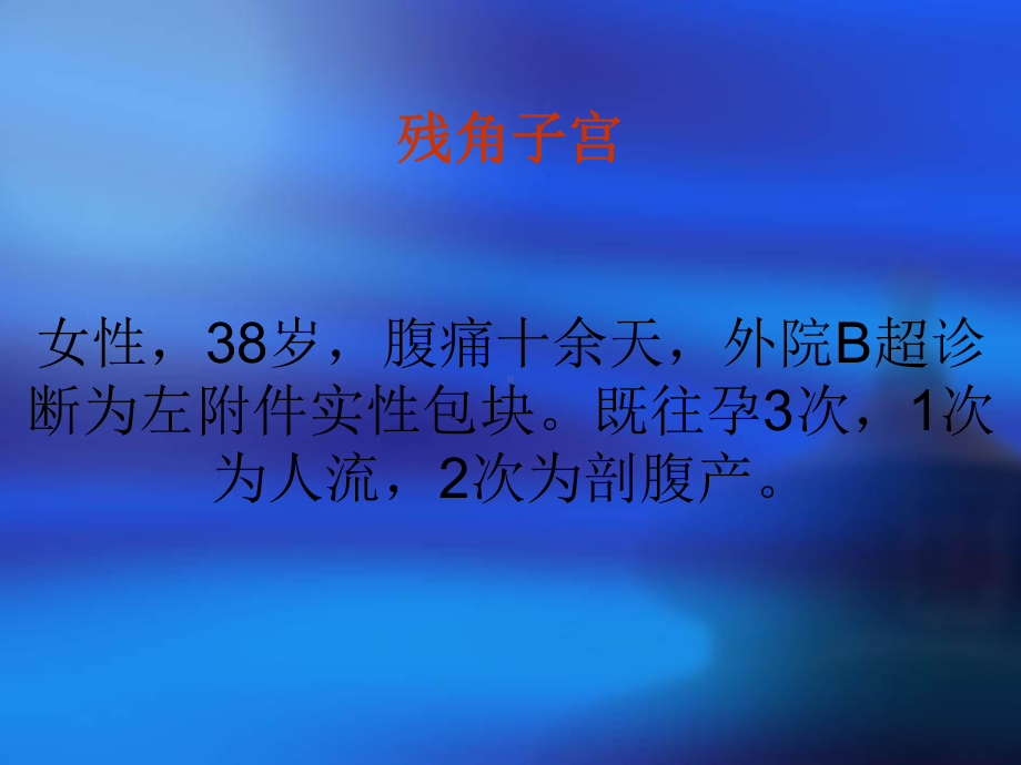 CT在女性生殖系统的应用课件.ppt_第2页