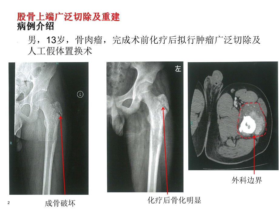 GMRS产品应用解剖与术式课件.pptx_第3页