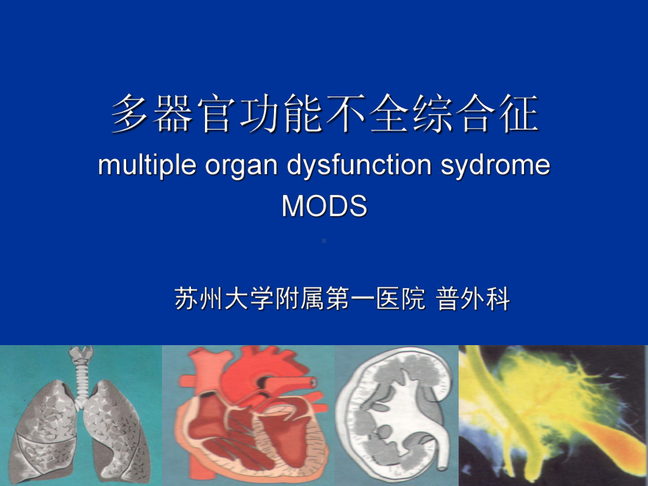 MOD多器官功能不全综合征-PPT课件.ppt_第1页