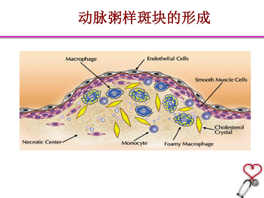 CMR在ACS患者中的应用课件.pptx_第2页