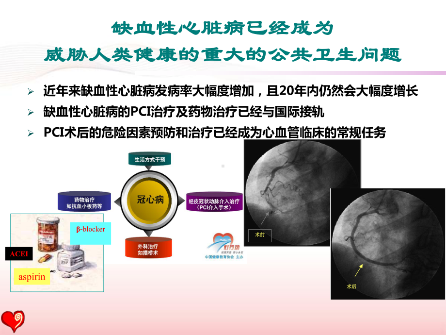 pci术后患者的心脏康复指南与现实盛京会ppt课件-44页精选.ppt_第2页