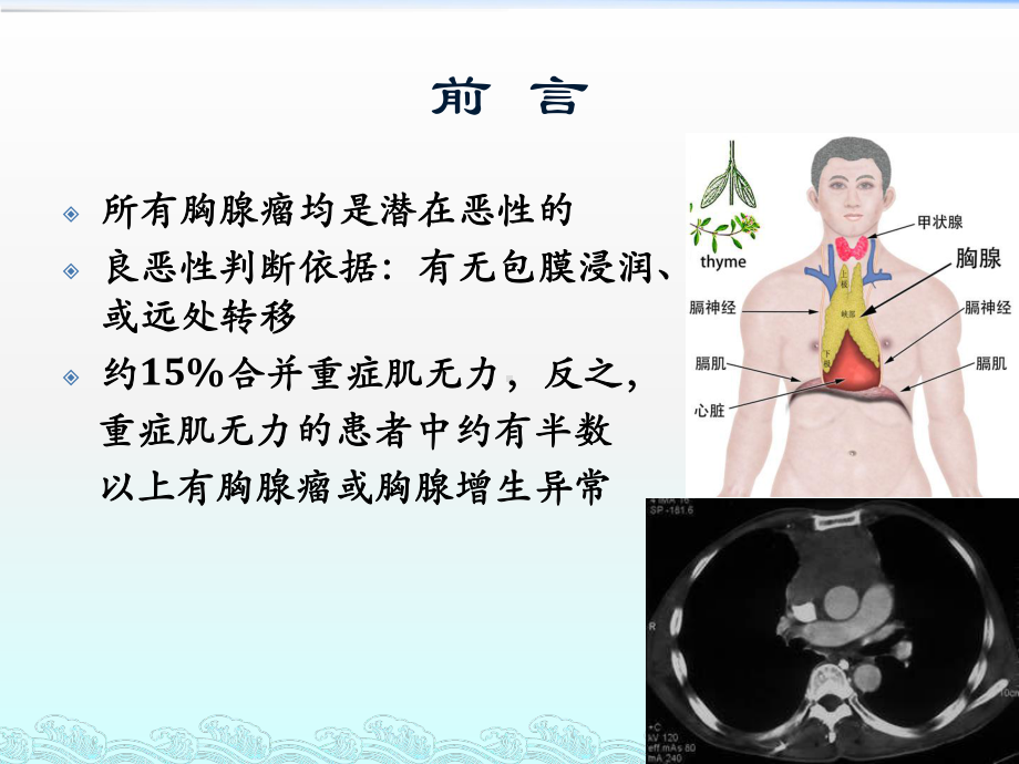 (完整版)胸腺瘤的分期治疗课件.ppt_第3页