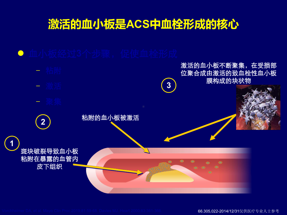 ACS规范化抗栓治疗策略-PPT精选课件.ppt_第3页