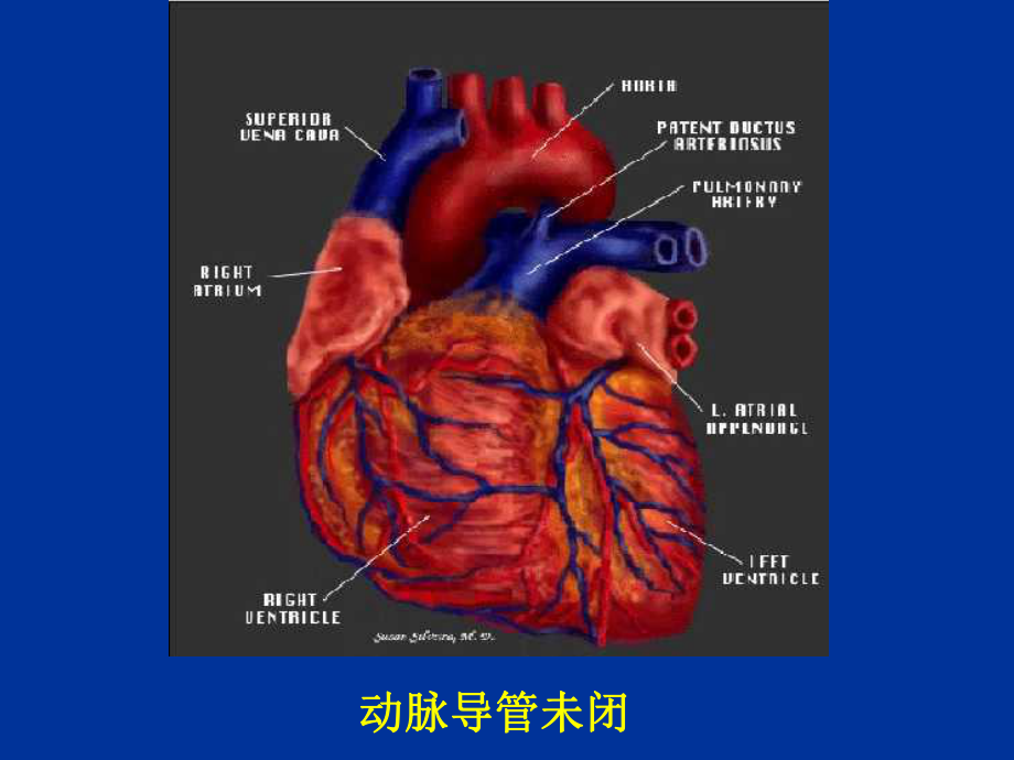 早产儿PDA-PPT精品课件.ppt_第2页