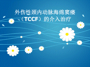 外伤性颈内动脉海绵窦瘘(TCCF)的介入治疗课件.ppt