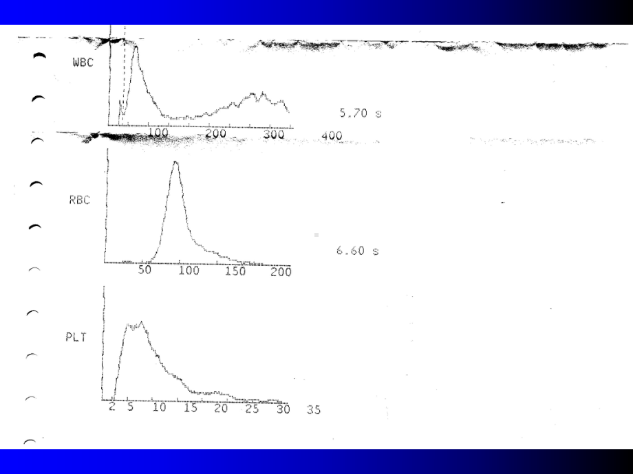 （医学ppt课件）-妊娠合并贫血.ppt_第3页