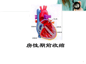 早搏ppt幻灯片课件.pptx